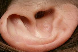 ear-closeup.jpg