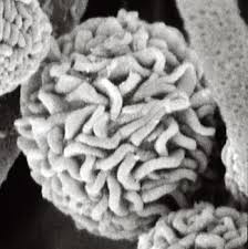 A conidium of Stachybotrys