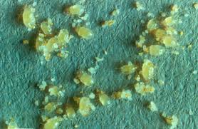 and dust mites (see