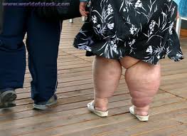 Stock Photo titled - Fat Legs