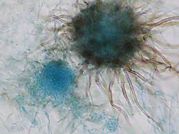 Chaetomium