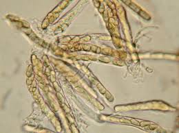 Image of Ascospores of
