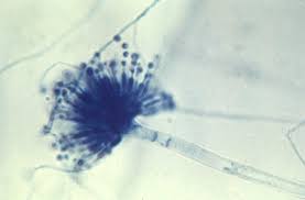 Aspergillus versicolor.