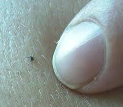 black-legged tick)