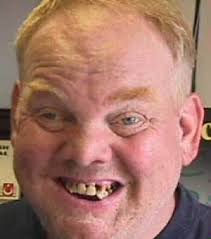 ... you're ugly, as stated earlier.