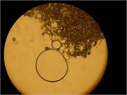 (Acremonium) ascospores (Acremonium) ascospores
